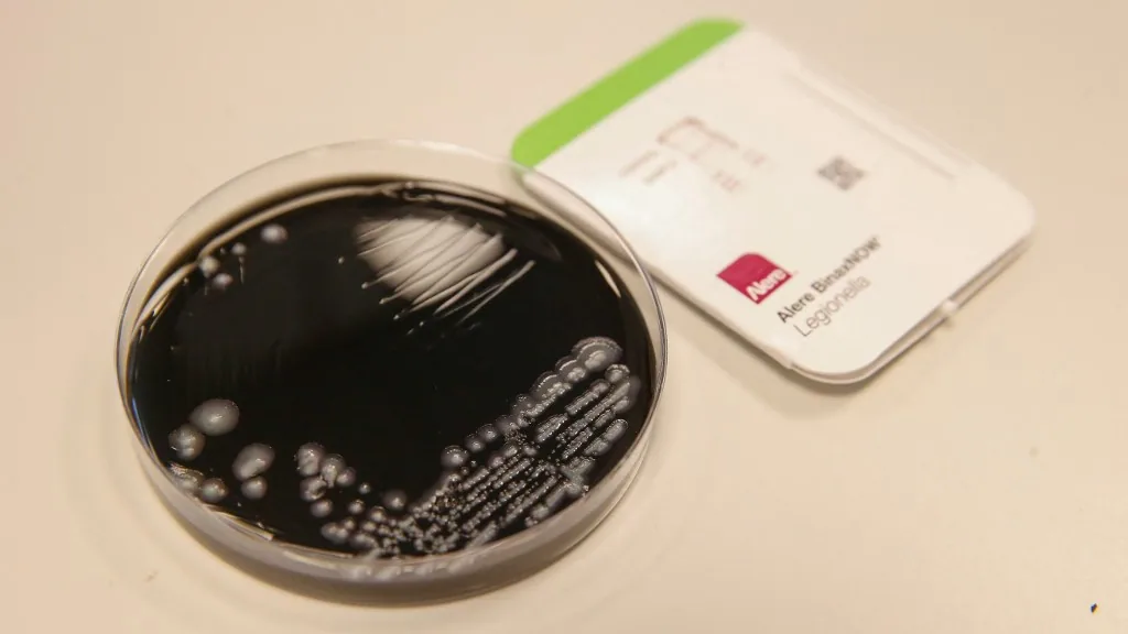 Keresik, de nem lelik a Legionella fertőzés gócát